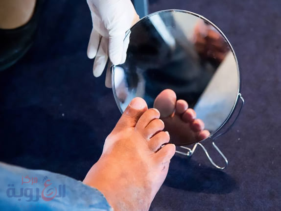 القدم السكري