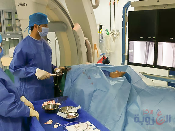 تسليك شرايين اليد