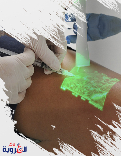 تقنية الكلاكس الحديثة