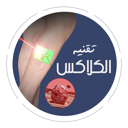 تقنية الكلاكس مركز العروبة