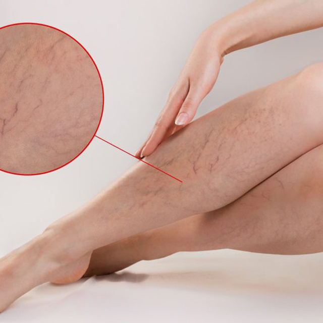 دوالى الساق