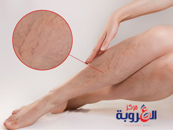 ظهور دوالى